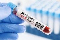 DINKES DKI Jakarta mengonfirmasi penambahan dua kasus cacar monyet atau monkeypox di Jakarta. Ilustrasi (iStockphoto/anilakkus)