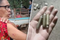 SEORANG warga memperlihatkan luka di lengannya usai bentrokan dengan aparat polisi. FOTO Kanan: warga menunjukan selongsong peluru yang ditemukan di lokasi bentrokan.(BBC Indonesia/James Watt)