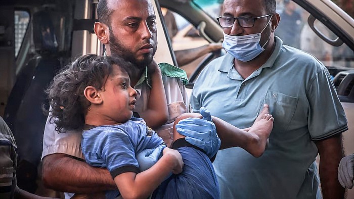 Anak-anak terbunuh dan terluka pada tingkat yang mengkhawatirkan di Gaza.(AFP/Mohammed Abed)