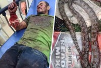 Aleria teringat bagaimana dia menggigit ular itu kembali saat panik ketika ular itu menyerang pada hari Rabu. Ular itu kemudian dimasak dan dimakan oleh penduduk setempat dalam video tersebut, kata Aleria kepada media lokal. [@ViralPress]