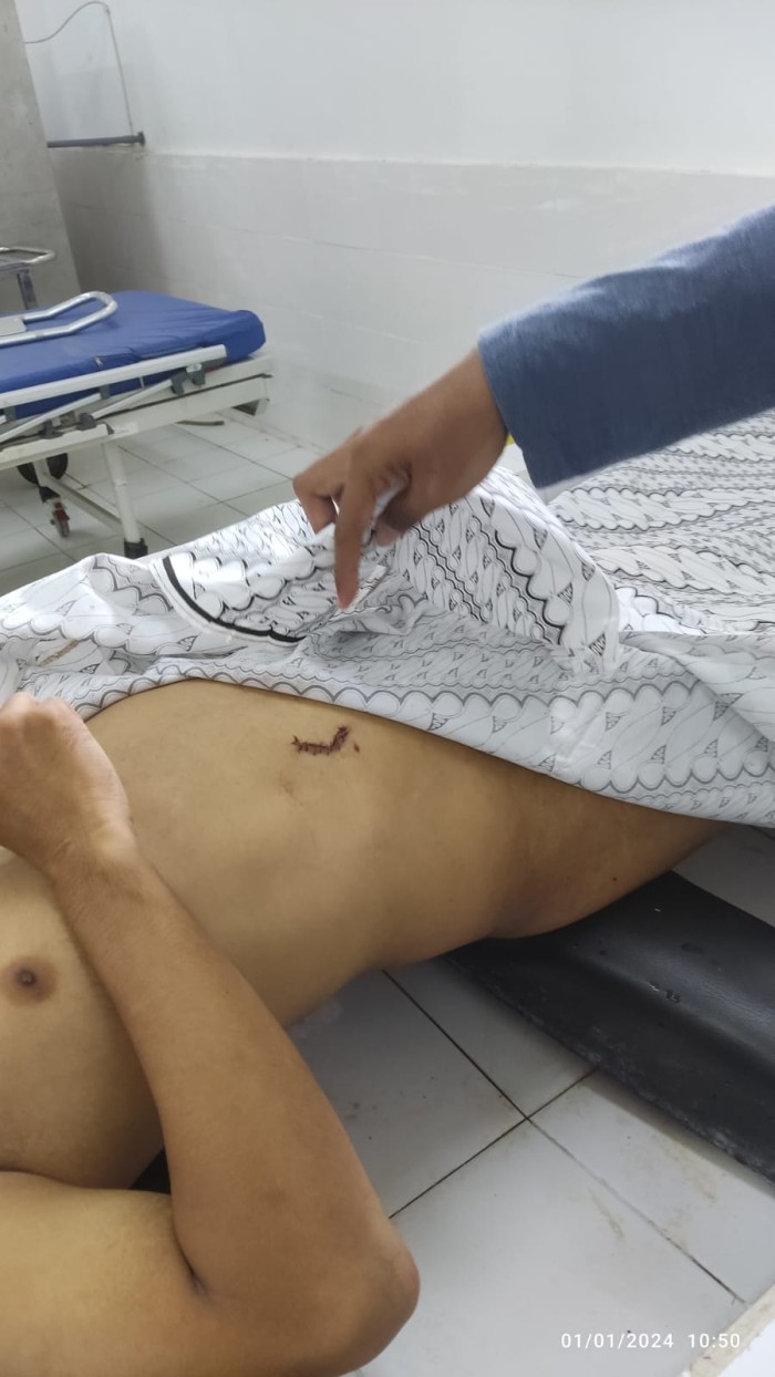 JR alias Ebeh (29),  korban pengeroyokan yang tewas saat berada di Jalan Antasan Kecil Timur, tepatnya di bawah Kolong Jembatan Kembar Banjarmasin Utara, Senin dinihari (1/1/2024),(SuarIndonesia/DO)