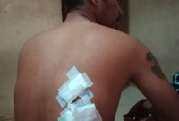 Bornif Ernando (31), menjadi korban penganiayaan. (SuarIndonesia/DO)