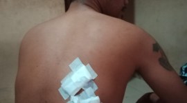 Bornif Ernando (31), menjadi korban penganiayaan. (SuarIndonesia/DO)