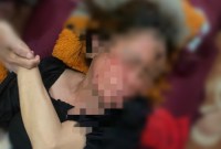 Siti Norrahmah (45)  korban penganiyaan