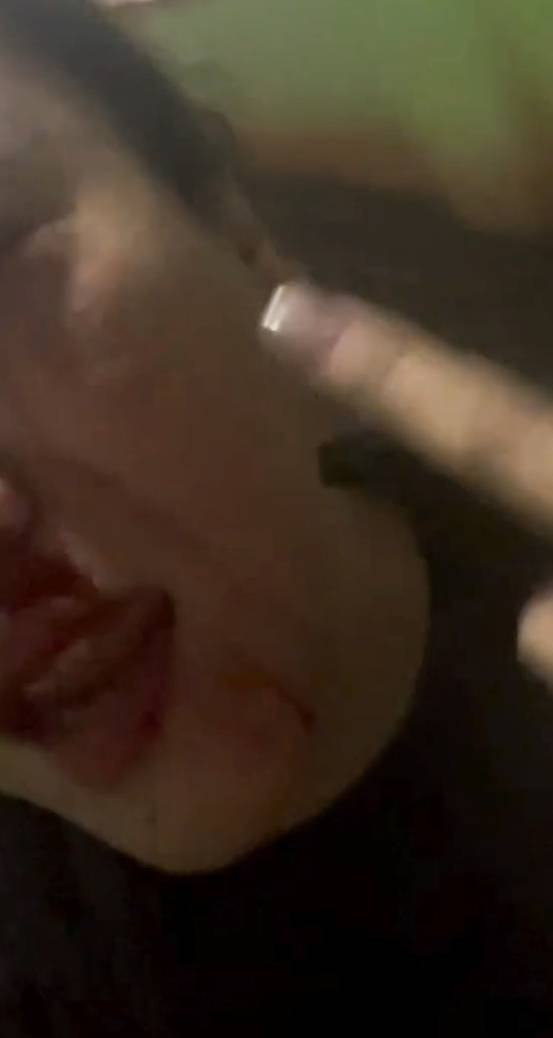 Korban Widya Natalia (31)