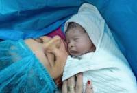 Foto Ilustrasi -- Seorang ibu setelah melahirkan melalui proses sesar. (Shutterstock)