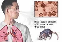 Foto Ilustrasi. (Foto: medlineplus.gov)