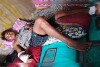 Kondisi salah seorang korban serangan beruang di Kecamatan Mentaya Hulu. (ANTARA/HO-Arsip BKSDA Sampit)