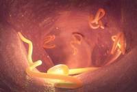 Foto Ilustrasi --  AS perdana laporkan kasus infeksi cacing sekrup parasit pemakan daging manusia dan hewan. (Foto: iStockphoto/Christoph Burgstedt)