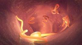 Foto Ilustrasi --  AS perdana laporkan kasus infeksi cacing sekrup parasit pemakan daging manusia dan hewan. (Foto: iStockphoto/Christoph Burgstedt)