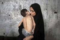 Seorang anak Palestina yang menderita kurang gizi dan cerebral palsy digendong ibunya di tempat pengungsian di Gaza, Palestina, 25 Juli 2025. (Dok ANTARA FOTO/Xinhua/Rizek Abdeljawad)