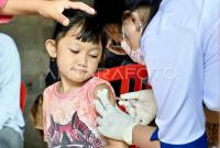 Foto Ilustrasi - Petugas kesehatan menyuntikkan vaksin campak kepada anak saat imunisasi campak massal gratis di kawasan Wanasari, Denpasar, Bali, Rabu (8/10/2025). (ANTARA FOTO/Fikri Yusuf)
