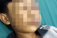 Irfan Zaki Azizi, seorang santri di Kubu Raya lebam pada wajah dan belum sadarkan diri. (Foto: Istimewa)