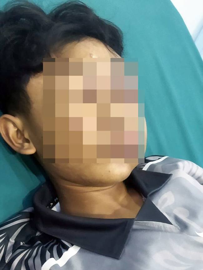 Irfan Zaki Azizi, seorang santri di Kubu Raya lebam pada wajah dan belum sadarkan diri. (Foto: Istimewa)
