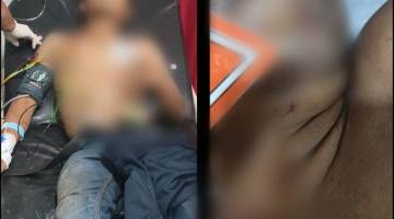 Korban (kanan) dan pelaku yang juga terluka.  